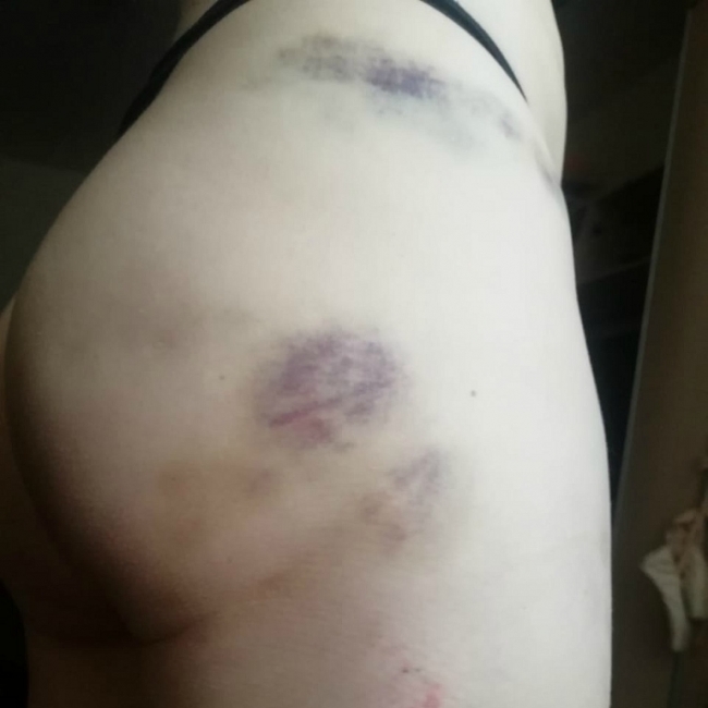 В подмосковной Ивантеевке женщина покусала двух полицейских